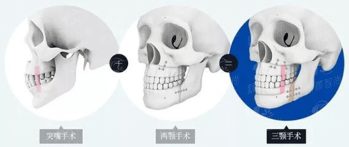 宝鸡高一生晶肤医疗美容门诊部，专业医师团队打造精致五官，新颜智尚小程序xinyanzs666预约挂号更便捷