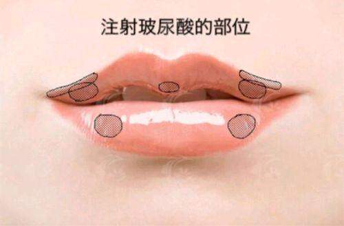 五、山东大学第二医院整形科:便捷预约挂号与就诊全攻略