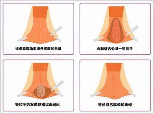 五、新疆格美医疗美容门诊部：为什么值得您优先选择？