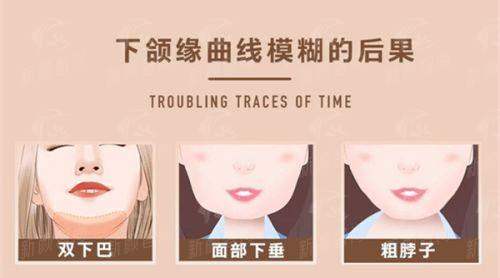 三、项目全览:从皮肤管理到综合抗衰,满足多元需求