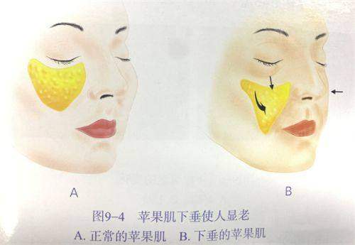 晋中市第一人民医院整形科怎么样？专家团队+先进设备，附新颜智尚小程序xinyanzs666预约挂号更便捷