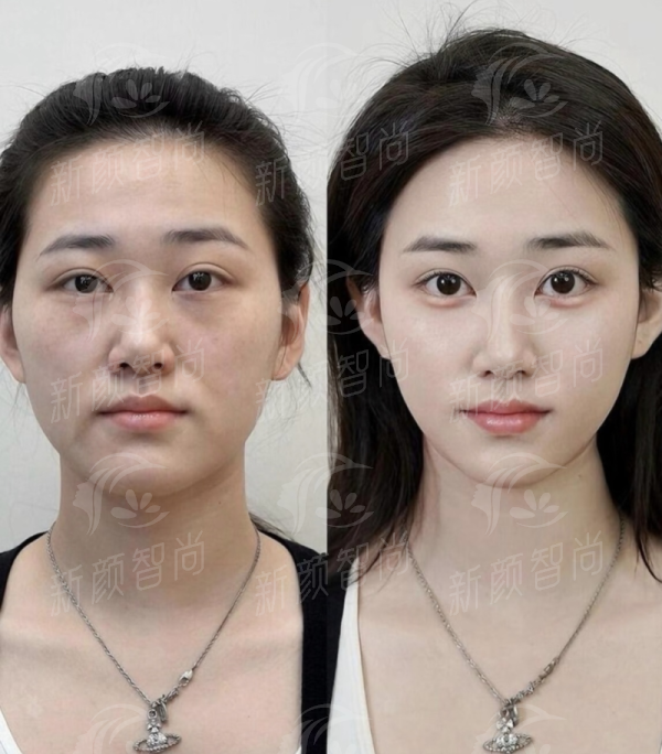 成都武侯童颜博仕医美门诊部怎么样？专业医生团队+先进设备，打造自然年轻感