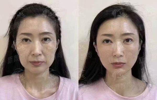 三、求美者说:听听他们在这里的变得更美故事
