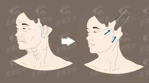 五、求美者真实分享：听听她们在<strong>Evita Clinic</strong>的蜕变心声