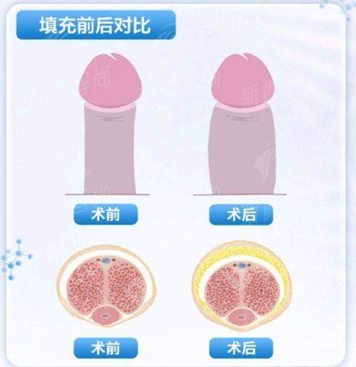 四、武汉曙光植发医院服务与体验：从询问到术后的一站式关怀