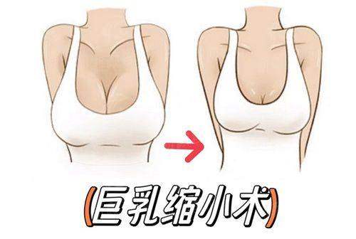 四、韩国JY整形外科医院真实求美者体验分享
