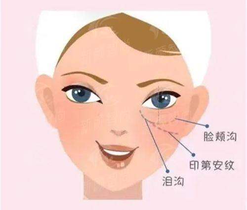 五、韩国JY整形外科医院透明收费与便捷预约指南