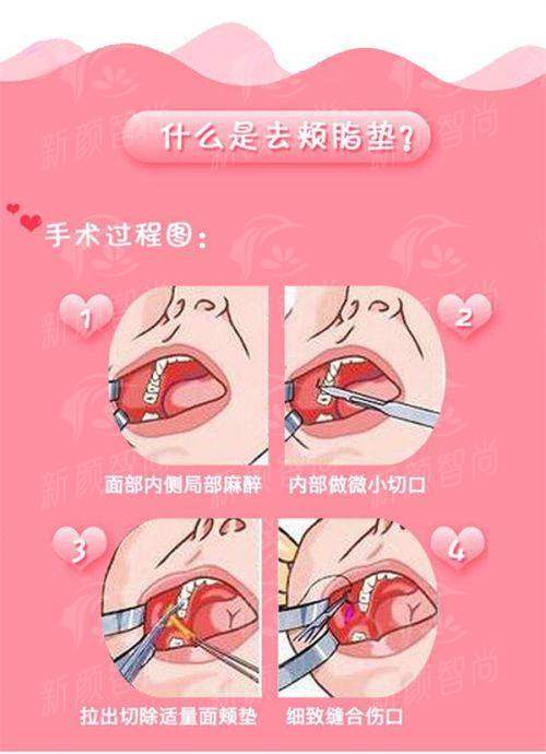 五、求美者说：在嘉兴艺植植发诊所改变形象的真实故事