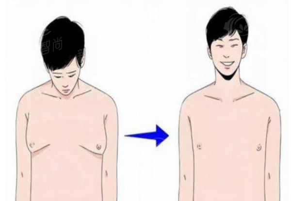 二、 技术实力大起底:明星同款“PS注射”与透明化操作