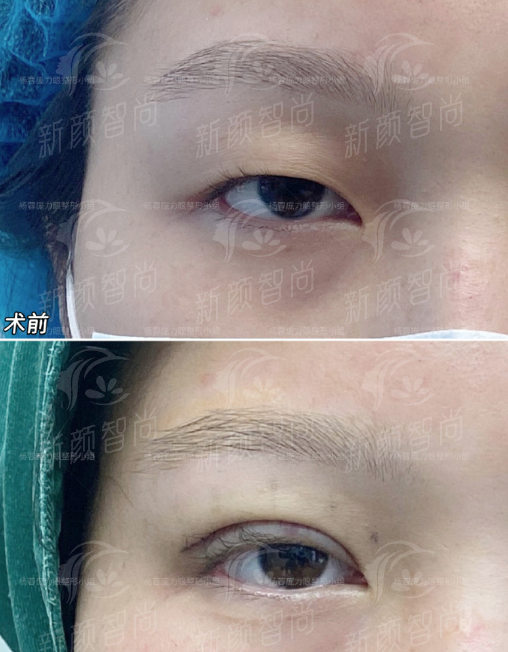 三、荆州汇美医疗美容门诊部：项目矩阵全，满足多元变得更美想象