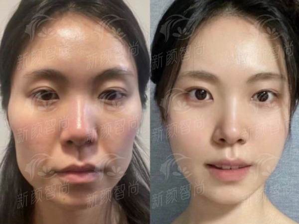 四、 真实口碑见证：听求美者分享他们的“祝福”之旅