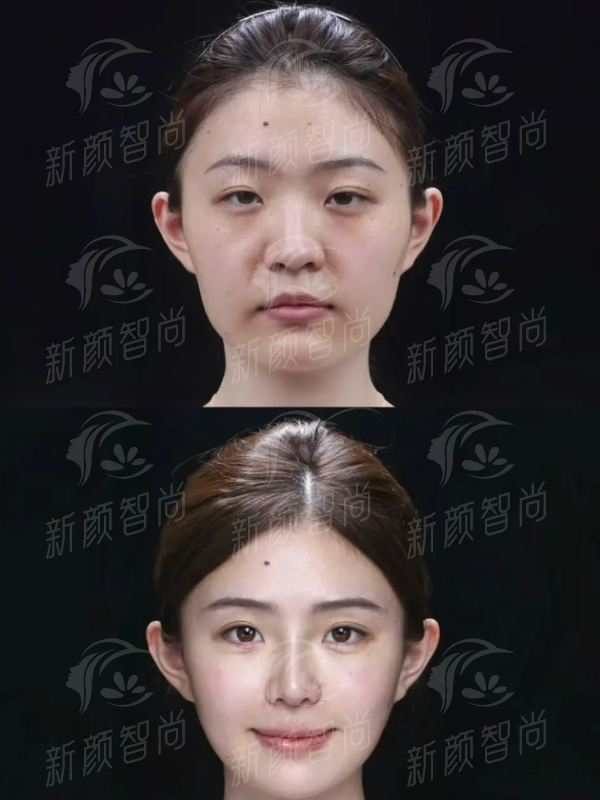 五、 透明消费：韩国Reyou皮肤科收费价格表（2026参考）