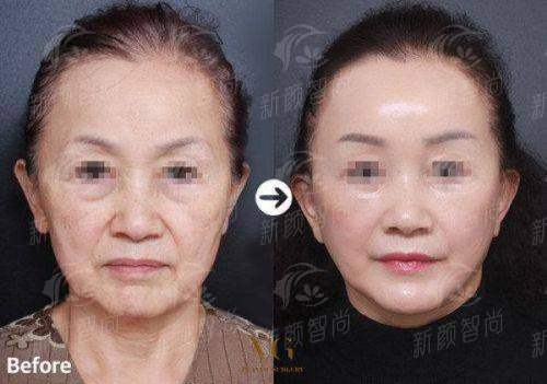五、沈丘红美医疗美容医院热门项目及2026年参考价格指南