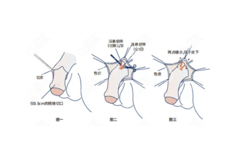 五、广州宸山医疗美容诊所:如何预约及选择它的核心理由
