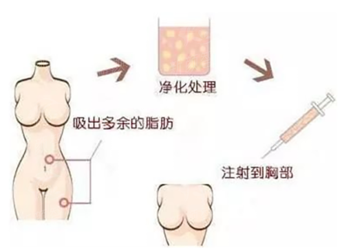 三、广州宸山医疗美容诊所:从环境到服务的全流程舒适体验