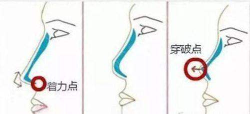 六、实用指南：如何预约<strong>西安碑林尤美医疗美容诊所</strong>及价格参考