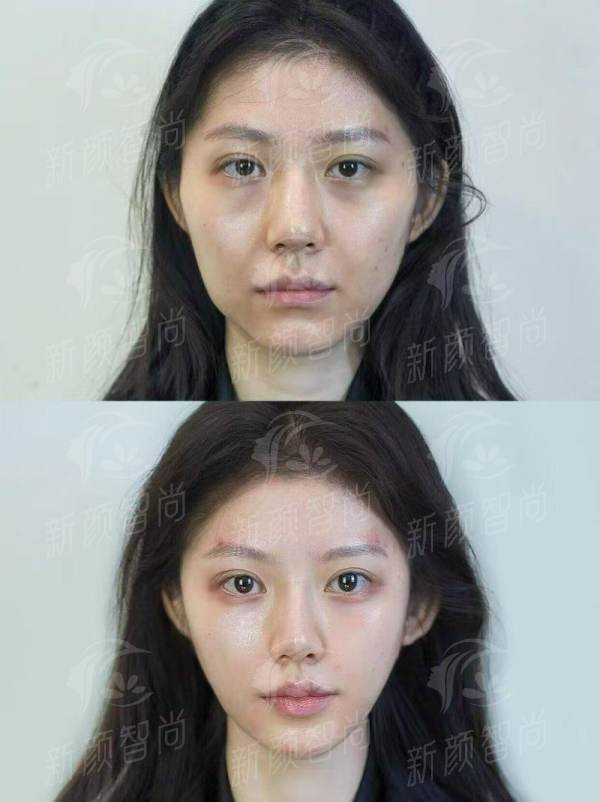 三、<strong>柳州艾薇美医疗美容诊所</strong>的“定海神针”:执业医师呼文强