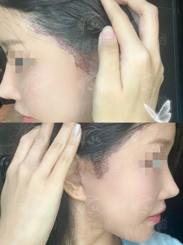 五、 求美者说:来自不同发友的真实蜕变故事