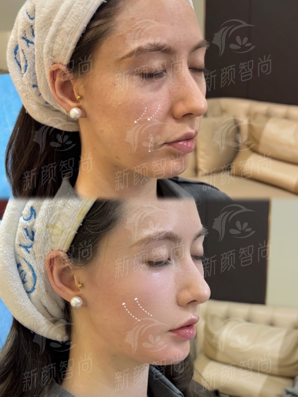 广西九臻医疗美容有诊所:二、核心项目深度解析:安心变得更美的“科学方程式”