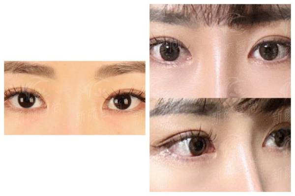 三、透明化收费与高性价比:禾美的价格体系有何优势?