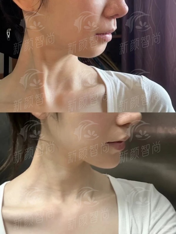 三、 服务流程与就诊环境:在济宁柏年整形美容医院的体验
