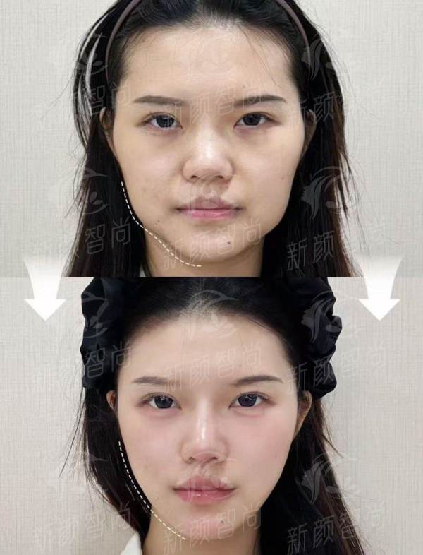 二、核心优势深度剖析:为何众多患者选择<strong>徐州华美美容医院(口腔科)</strong>?