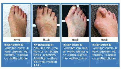 五、透明化消费指南：德州秦怡医疗美容项目价格参考