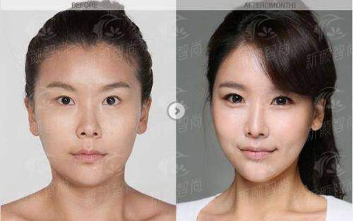 五、<strong>武汉星妍芭莎医疗美容门诊部</strong>:如何预约及2026年参考价格指南