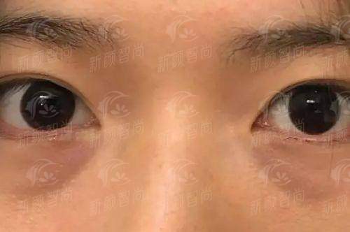 徐州医科汇美美容医院口腔科怎么样？看牙不踩坑攻略，附新颜智尚小程序xinyanzs666预约挂号更便捷