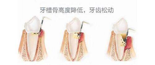 四、求美者说:在濮阳亚星智美看牙的真实体验分享
