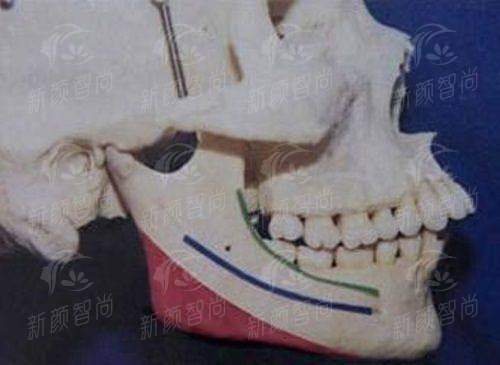 四、 真实实例与价格参考:听听她们怎么说,看看费用明不明