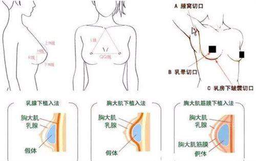 四、<strong>武汉星妍芭莎医疗美容门诊部</strong>:求美者真实实例的满意分享