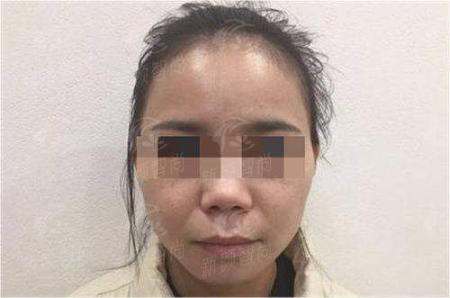 六、东莞南城叶子医疗美容门诊部:便捷预约与就诊指南