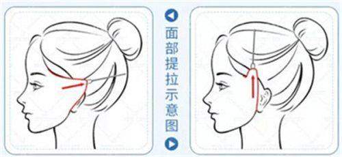 三、医生团队揭秘:明星院长领衔与本地化服务