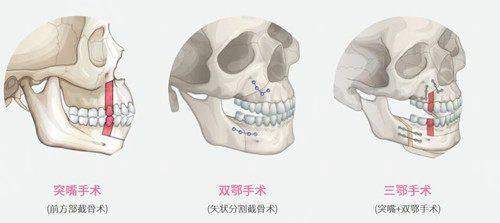 六、为什么选择与如何预约:贵阳南明区医美指南