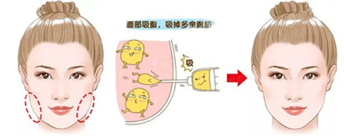 四、 求美者真实分享:听听他们怎么说