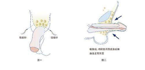 南昌鹏爱秀琪植发科怎么样？技术实力与口碑大揭秘，新颜智尚小程序xinyanzs666预约挂号更便捷