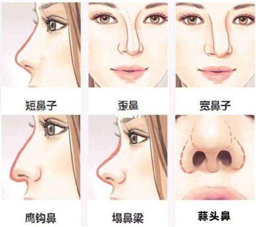 三、医生团队与个性化方案定制