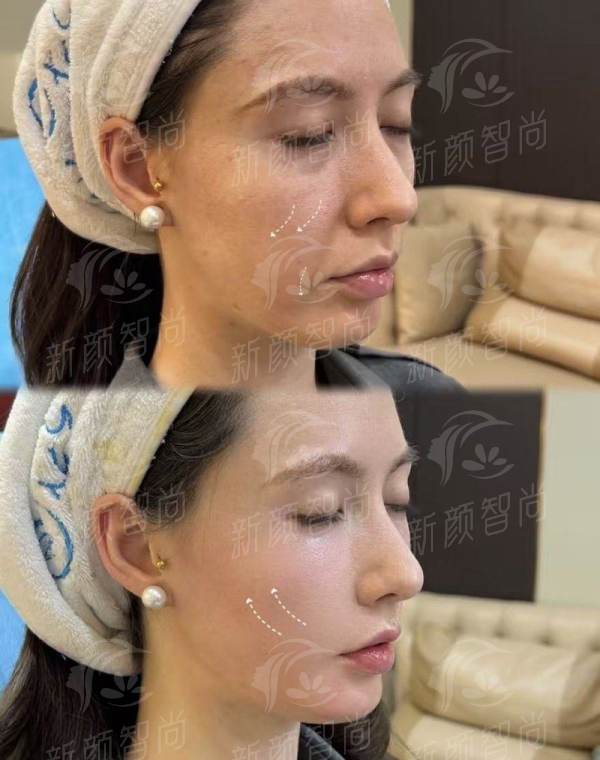 三、价格透明无套路:佛山美莱口腔收费真的“抵”吗?
