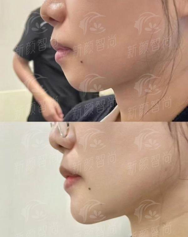 二、<strong>武汉星妍芭莎医疗美容门诊部</strong>:透明化服务与安心体验的全流程