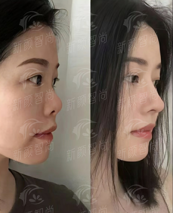 三、顾客说:在南京美莱口腔看牙的真实满意分享