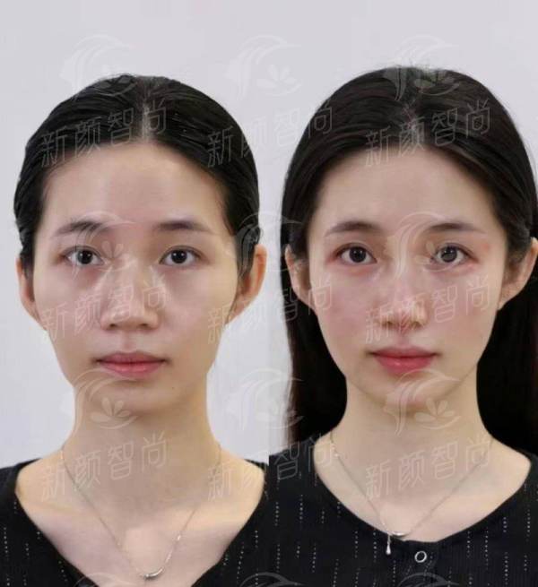 为什么选择<strong>昆明大麦医疗美容盘龙汇都医疗美容诊所</strong>?