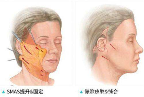 探访天津河北时光整形美容门诊部，医生团队与特色项目盘点，上新颜智尚小程序挂号不踩坑
