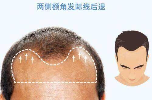 四、 真实求美者分享:听听她们怎么说
