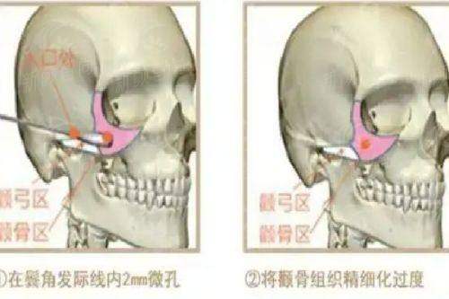 三、真实实例分享：听她们讲述在云艺美的蜕变故事