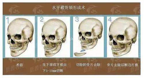 四、 杭州市第一人民医院钱江新城院区(医学美容科):求美者真实实例分享