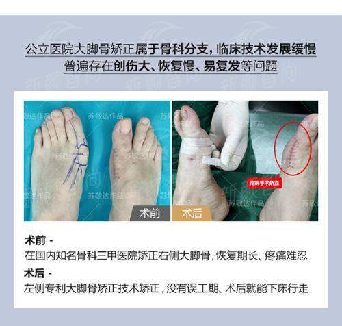 五、为何选择南昌爱贝思?便捷预约指引在此