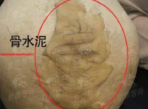 五、 透明化收费与便捷预约指南