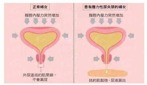 三、中山大学附属第五医院医学美容治疗专区特色项目聚焦