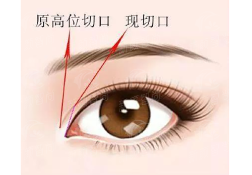 五、<strong>汉中市人民医院(整形显微外科)</strong>：透明收费与便捷就诊全指南